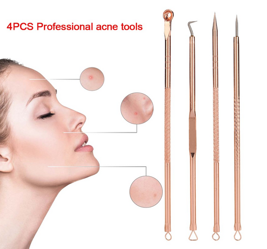 Blackhead Remover/Pimple Comedone Extractor Tool 4 pcs Set