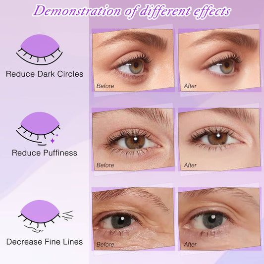 Luxury Gold Eye Mask with Hyaluronic Acid | Sell per unit